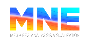 BrainAccess Features - BrainAccess BrainAccess Features - BrainAccess